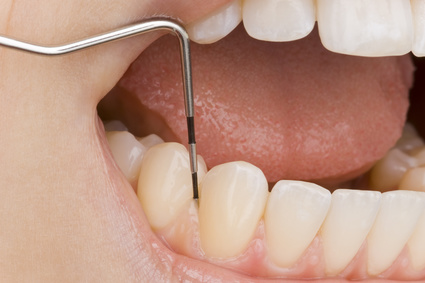 periodoncia dentista