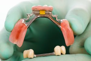 protesis dental implantosoportada