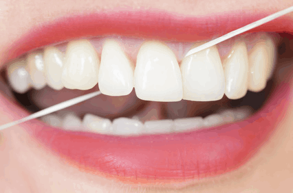 fotografia de periodoncia