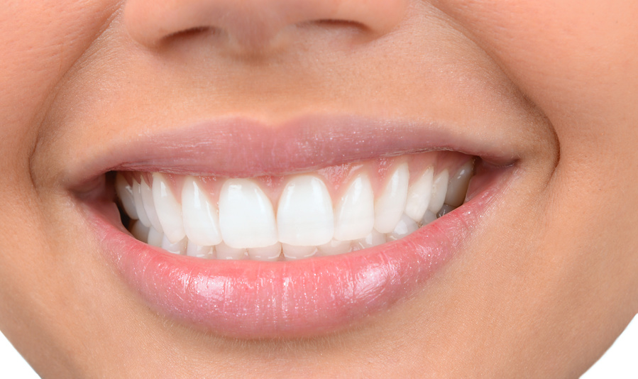 sonrisa de mujer dientes blancos